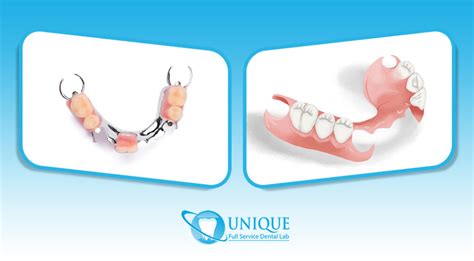 what is the metal housing of the denture|plastic partials vs metal.